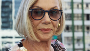 chirurgie esthetique après 60