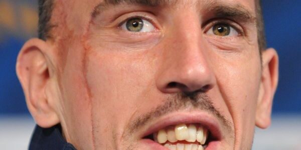 Traitements des cicatrices : que faire ?