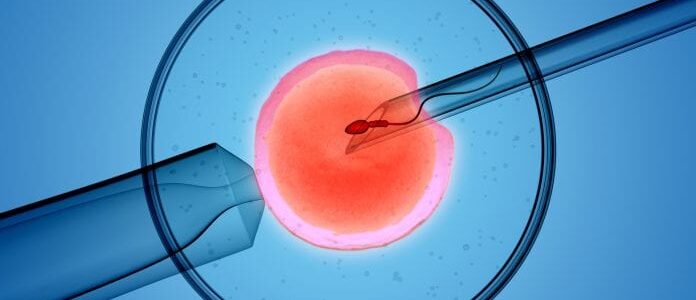 Un pas vers la récupération de la reproduction chez les femmes qui survivent au cancer infantile Un pas vers la récupération de la reproduction chez les femmes qui survivent au cancer infantile