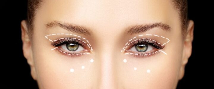 Blefaroplastia Miami : Devuelva la luminosidad y juventud a sus ojos