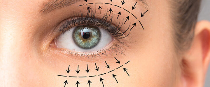 La Blépharoplastie pour retrouver un regard plus jeune La Blépharoplastie pour retrouver un regard plus jeune