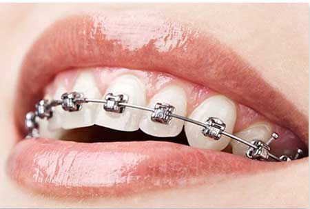 dentisterie esthetique Tunisie