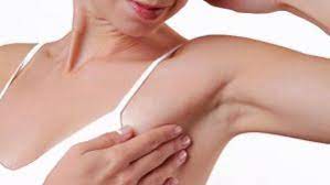 hiperhidrosis-tunisia