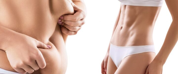 6 règles pour réussir sa liposuccion 6 règles pour réussir sa liposuccion