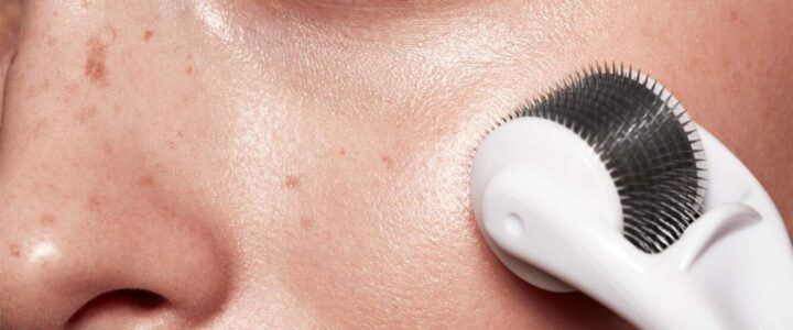 Le Microneedling : c’est quoi ? Quels sont ses bienfaits sur la peau ? Le Microneedling : c’est quoi ? Quels sont ses bienfaits sur la peau ?