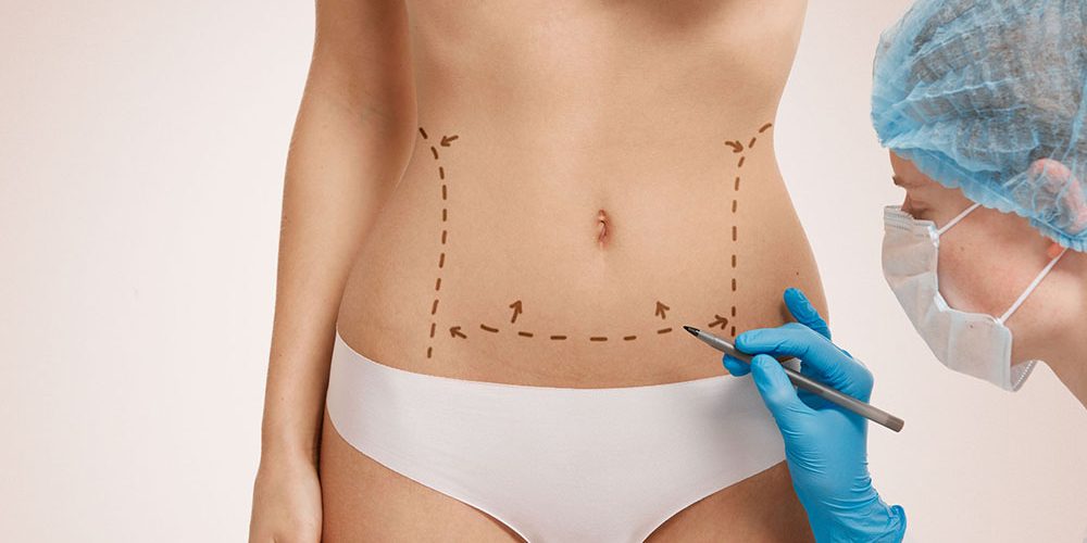 Abdominoplastie Tunisie meilleur chirurgien : Chirurgie ventre prix