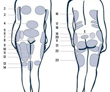360° Lipo: Sculpt your figure from every angle. 360° Lipo: Sculpt your figure from every angle.