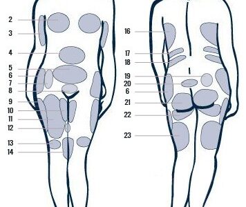 Lipo 360°: Esculpe tu figura desde todos los ángulos.