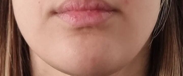 Comment lutter contre le relâchement du bas du visage : solutions efficaces et pratiques