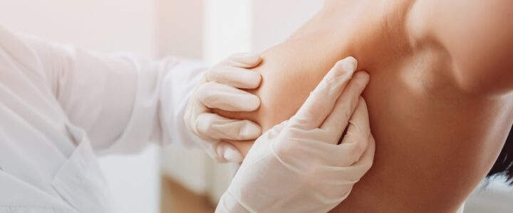Comment traiter l’hypertrophie des seins ?
