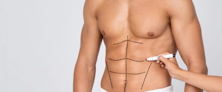 quel est le tarif d’une chirurgie esthétique liposuccion six pack Ottawa : Guide des coûts et options