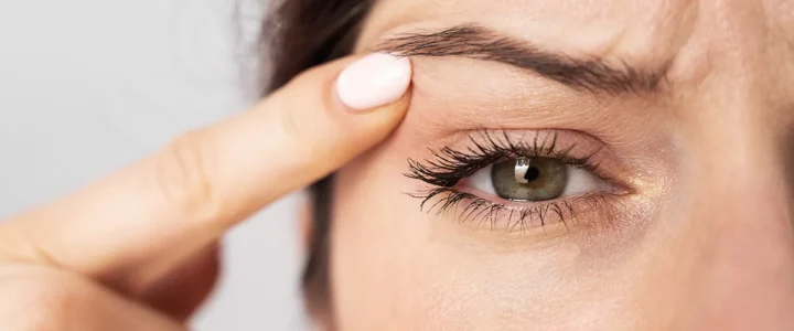 Chirurgie esthetique des paupières tombantes