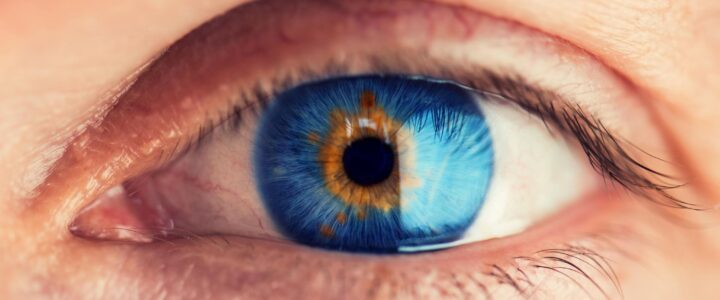 Chirurgie esthétique pour changer la couleur des yeux : Tout ce que vous devez savoir