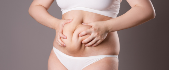 Chirurgie esthetique ventre fripé : Guide Complet et prix