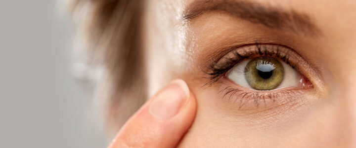 Comment bien cicatriser après une blépharoplastie ?