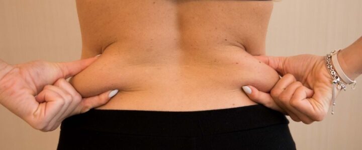 Chirurgie esthétique pour éliminer la graisse du dos : Guide complet et options disponibles