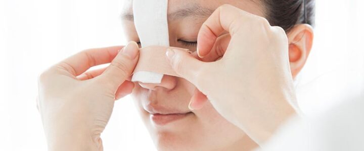 Cartilage du Nez Cassé : Que Faire ?
