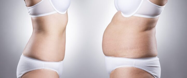 Quand tomber enceinte après une abdominoplastie