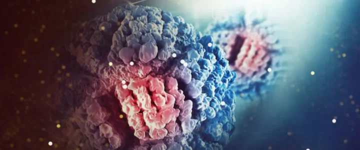 Qu’est-ce que la chirurgie carcinologique ?