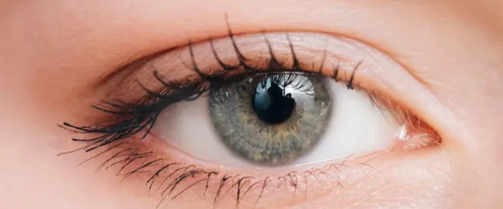 Tension oculaire : causes, symptômes et traitements