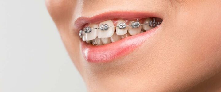 Orthodontie : la croissance du visage