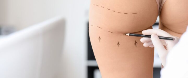 Comment perdre la banane sous fessier ?
