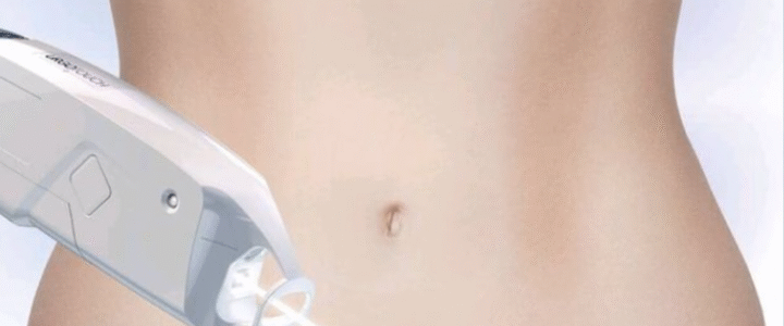 Laser Urgo-Touch : la nouvelle ère de la cicatrisation après chirurgie